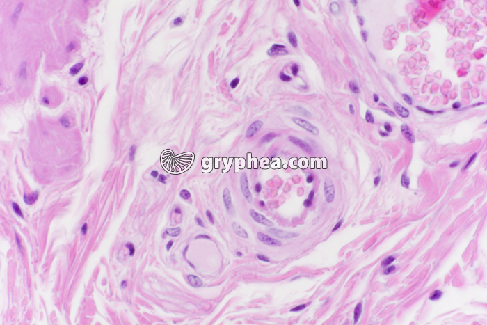 Vaisseaux lymphatiques x200 - gryphea.com